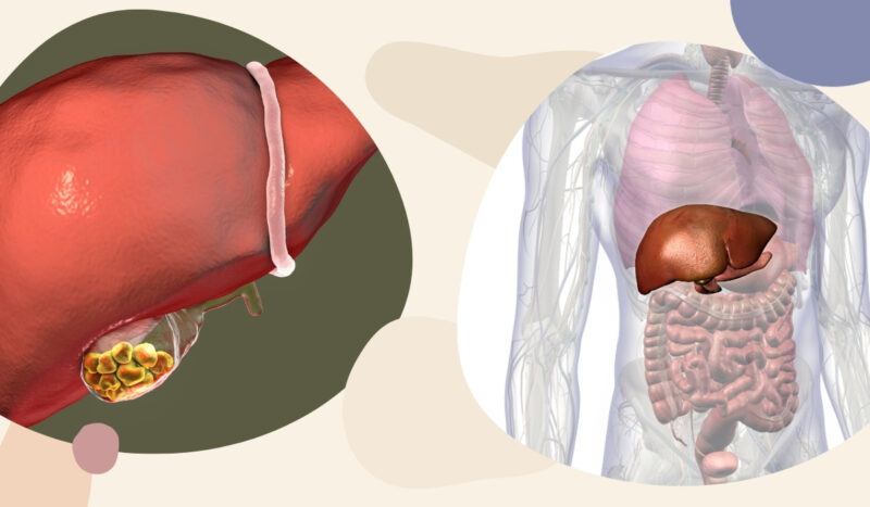 Gallbladder and liver pain