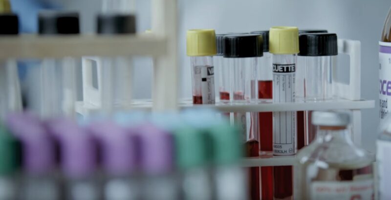 Set of blood collection tubes, ready for laboratory analysis